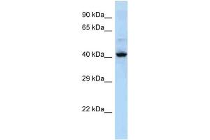 Host: Rabbit Target Name: KRT36 Sample Type: NCI-H226 Whole cell lysates Antibody Dilution: 1. (Keratin 36 抗体  (Middle Region))