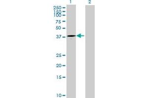 Western Blot analysis of ART4 expression in transfected 293T cell line by ART4 MaxPab polyclonal antibody. (ART4 抗体  (AA 1-314))