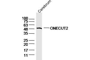 Mouse cerebrum lysates probed with ONECUT2 Polyclonal Antibody, Unconjugated  at 1:300 overnight at 4˚C. (ONECUT2 抗体  (AA 401-504))