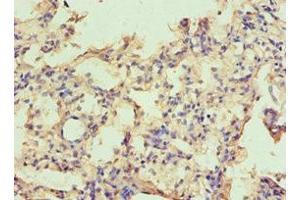 Immunohistochemistry of paraffin-embedded human lung tissue using ABIN7146531 at dilution of 1:100 (CAPNL1 抗体  (Catalytic Subunit))
