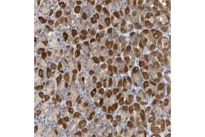 Immunohistochemical staining of human stomach with VTA1 polyclonal antibody  shows strong cytoplasmic positivity in Parietal cells at 1:50-1:200 dilution. (VTA1 抗体)
