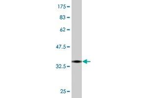 Western Blotting (WB) image for anti-Tribbles Pseudokinase 2 (TRIB2) (AA 254-343) antibody (ABIN565396)