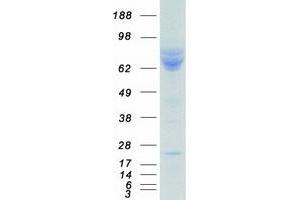 Validation with Western Blot