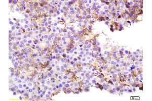 Formalin-fixed and paraffin embedded rat melanoma labeled with Anti-SPANX Polyclonal Antibody, Unconjugated (ABIN721675) at 1:200 followed by conjugation to the secondary antibody and DAB staining. (SPANXC 抗体  (AA 21-97))