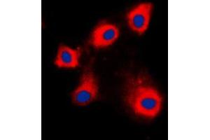 Immunofluorescent analysis of HSPE1 staining in NIH3T3 cells. (HSPE1 抗体  (Center))