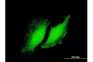 Immunofluorescence of purified MaxPab antibody to RYBP on HeLa cell. (RYBP 抗体  (AA 1-228))