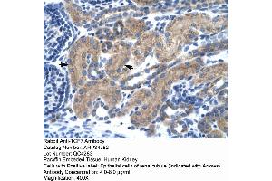 Human kidney (TCF7 抗体  (Middle Region))