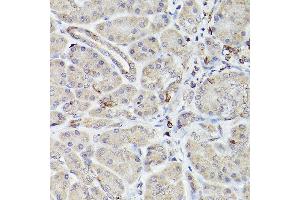Immunohistochemistry (IHC) image for anti-B-Cell CLL/lymphoma 2 (BCL2) antibody (ABIN7265810)