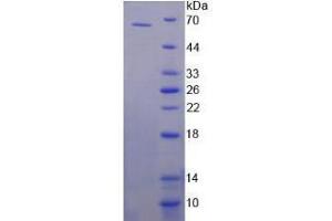 SDS-PAGE analysis of Human Specificity Protein 1 Protein. (SP1 蛋白)