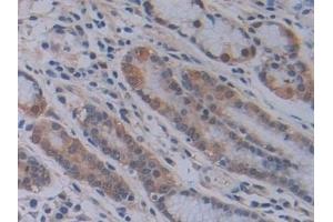 Immunohistochemistry (IHC) image for anti-Phosphatidylethanolamine Binding Protein 1 (PEBP1) (AA 2-187) antibody (ABIN7436330)