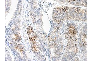 Image no. 2 for anti-Chemokine (C-C Motif) Ligand 20 (CCL20) antibody (ABIN465457) (CCL20 抗体)