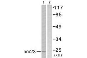 Western blot analysis of extracts from K562 cells, using NM23 Antibody. (NME1 抗体  (AA 91-140))