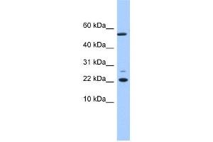 WB Suggested Anti-DPH4 Antibody Titration: 0. (DNAJC24 抗体  (N-Term))