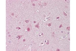 Immunohistochemistry (IHC) image for anti-Sterol Regulatory Element Binding Transcription Factor 1 (SREBF1) (AA 461-510) antibody (ABIN6748655)