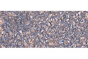 Immunohistochemistry of paraffin-embedded Human tonsil tissue using TTC38 Polyclonal Antibody at dilution of 1:85(x200) (TTC38 抗体)