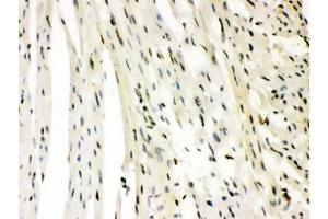 IHC testing of FFPE rat heart with SLUG antibody. (SLUG 抗体)