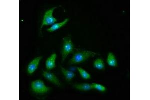 Immunofluorescence staining of A549 cells with ABIN7167028 at 1:466, counter-stained with DAPI. (AKT2 抗体  (AA 2-481))