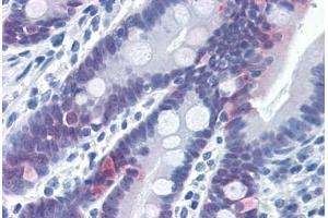 Human Small Intestine (formalin-fixed, paraffin-embedded) stained with CASP6 antibody ABIN337396 at 5 ug/ml followed by biotinylated goat anti-rabbit IgG secondary antibody ABIN481713, alkaline phosphatase-streptavidin and chromogen. (Caspase 6 抗体  (Cleavage Site))