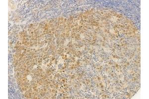 ABIN6255330 and ABIN6277725 at 1/100 staining human normal tonsil tissue by IHC-P.