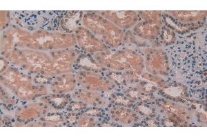 Detection of MMP11 in Human Kidney Tissue using Polyclonal Antibody to Matrix Metalloproteinase 11 (MMP11)