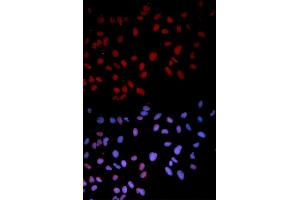 Immunofluorescence analysis of U2OS cells using Phospho-MAPK14-T180 antibody (ABIN5969910). (MAPK14 抗体  (pThr180))