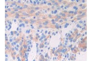 DAB staining on IHC-P; Samples: Mouse Uterus Tissue (GAD 抗体  (AA 1-97))