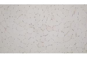 Human skeletal muscle: immunohistochemical staining for Utrophin. (Utrophin 抗体)