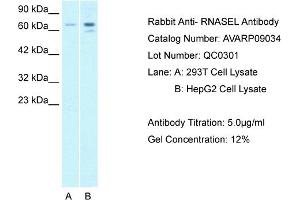Host: Rabbit Target Name: RNASEL Sample Tissue: Human 293T Whole Cell Antibody Dilution: 1ug/ml (RNASEL 抗体  (C-Term))