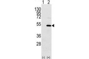 Western Blotting (WB) image for anti-Y Box Binding Protein 1 (YBX1) antibody (ABIN3002604) (YBX1 抗体)