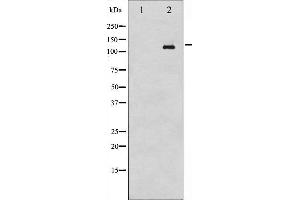 Western Blotting (WB) image for anti-C-Abl Oncogene 1, Non-Receptor tyrosine Kinase (ABL1) (pTyr393), (pTyr412) antibody (ABIN6256727)