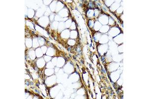 Immunohistochemistry of paraffin-embedded human colon using  Rabbit mAb (ABIN7265740) at dilution of 1:100 (40x lens). (ABCF1 抗体)