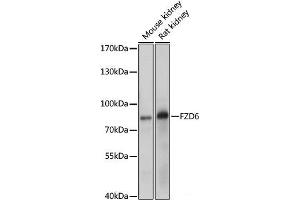 Western blot analysis of extracts of various cell line using FZD6 Polyclonal Antibody at dilution of 1:1000. (FZD6 抗体)