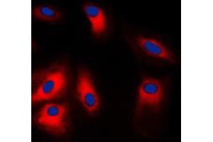 Immunofluorescent analysis of GRP78 staining in HeLa cells. (GRP78 抗体  (C-Term))