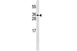 PDGFC antibody western blot analysis in MDA-MB231 lysate. (PDGFC 抗体  (AA 74-103))