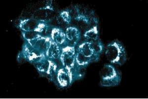 Immunofluorescence staining of A431 cells (Human epithelial carcinoma, ATCC CRL-1555). (AKAP1 抗体  (AA 66-212))