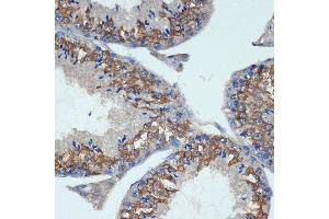 Immunohistochemistry of paraffin-embedded mouse testis using CHMP2B Rabbit mAb (ABIN7266290) at dilution of 1:100 (40x lens). (CHMP2B 抗体)