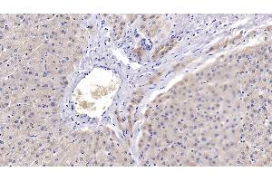 Detection of PRDX3 in Human Liver Tissue using Polyclonal Antibody to Peroxiredoxin 3 (PRDX3) (Peroxiredoxin 3 抗体  (AA 5-233))