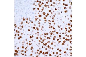 Immunohistochemistry (IHC) image for anti-Tumor Protein P53 Binding Protein 1 (TP53BP1) (AA 350-400) antibody (ABIN7455070) (Recombinant TP53BP1 抗体  (AA 350-400))