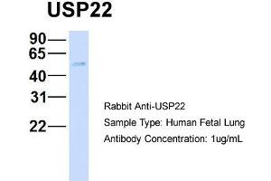 Host: Rabbit   Target Name: USP22   Sample Tissue: Human Fetal Lung  Antibody Dilution: 1. (USP22 抗体  (Middle Region))