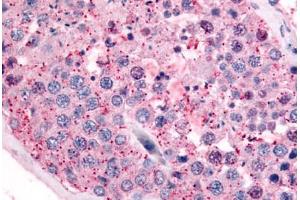 Human Testis (formalin-fixed, paraffin-embedded) stained with PAK6 antibody ABIN213527 at 10 ug/ml followed by biotinylated goat anti-rabbit IgG secondary antibody ABIN481713, alkaline phosphatase-streptavidin and chromogen. (PAK6 抗体  (N-Term))