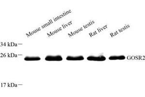 Western blot analysis of Membrin (ABIN7074118) at dilution of 1: 8000 (GOSR2 抗体)