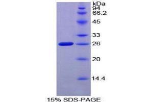 SDS-PAGE (SDS) image for Coagulation Factor VIII-Associated 1 (F8A1) (AA 171-375) protein (His tag) (ABIN1878903) (Coagulation Factor VIII-Associated 1 (F8A1) (AA 171-375) protein (His tag))