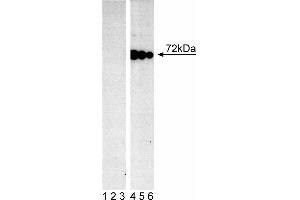 Lysate from control (First Panel) and pervanadate-treated (Second Panel) Ramos cells (Burkitt's lymphoma) were probed with mAb I120-722 at concentrations of 0.