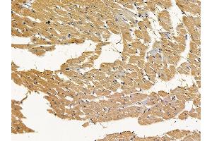 anti-YTH Domain Family, Member 1 (YTHDF1) (N-Term) antibody