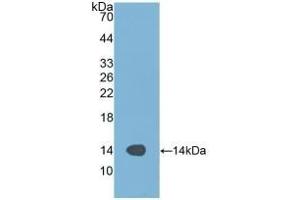 Detection of Recombinant ALT, Human using Polyclonal Antibody to Alanine Aminotransferase (ALT) (ALT 抗体  (AA 367-480))