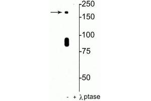 Western blot of rat hippocampal lysate showing specific immunolabeling of the ~180 kDa NR2B subunit of the NMDAR phosphorylated at in the first lane (-). (GRIN2B 抗体  (pSer1480))