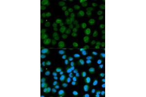 Immunofluorescence analysis of HeLa cell using EMD antibody. (Emerin 抗体)