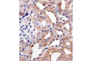 Immunohistochemical analysis of paraffin-embedded M. (RPS6 抗体)