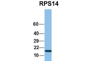 Western Blotting (WB) image for anti-Ribosomal Protein S14 (RPS14) (Middle Region) antibody (ABIN2778744)