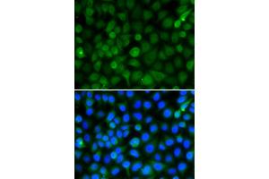 Immunofluorescence analysis of A549 cells using HIST2H4B antibody. (Histone H4 抗体)